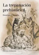Trepanacion Prehistorica,La